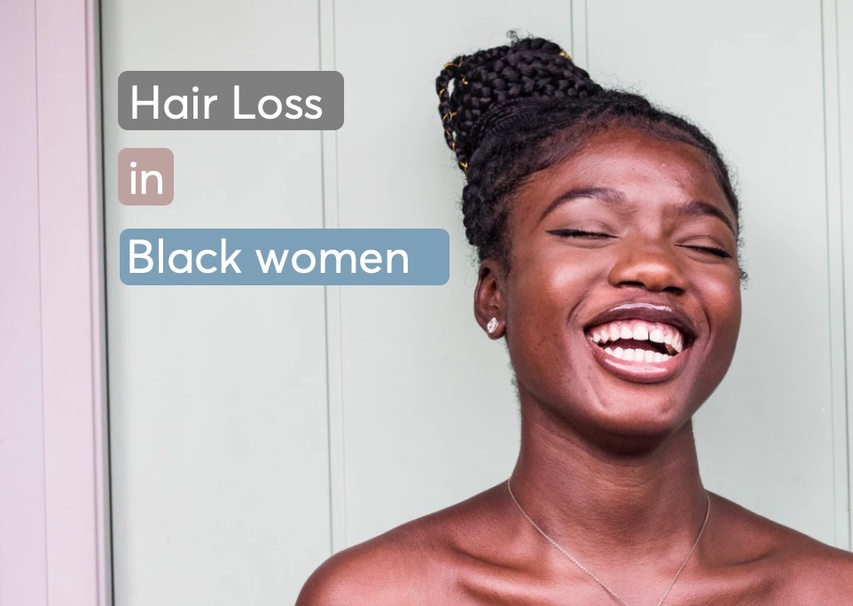 A woman with black hair concerned about hair loss and thinning