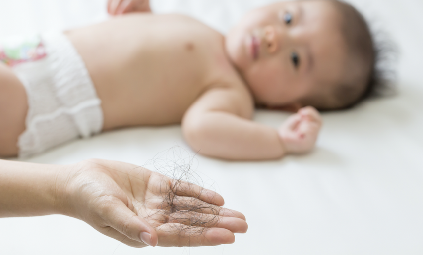 Woman holding hair postpartum hairloss