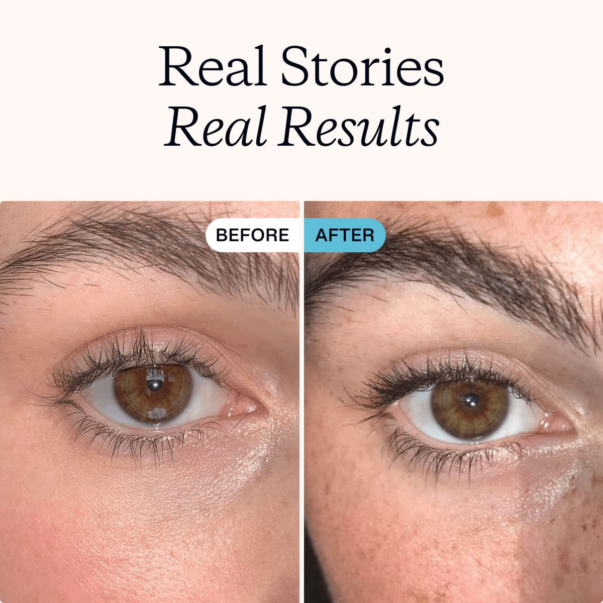 Advanced Eyebrow Serum | MDhair