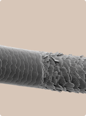 Electron microscopy
